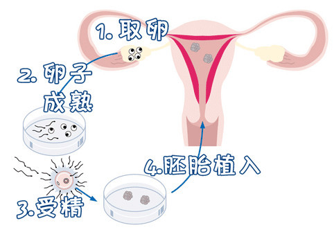 嘉和优生